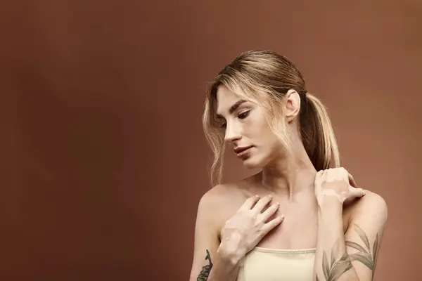 Una giovane donna con vitiligine e un tatuaggio sul braccio posa con le spalle nude su uno sfondo beige. — Foto stock