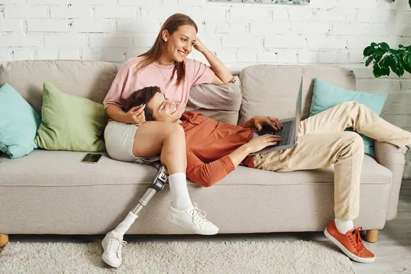 A woman with a prosthetic leg and her boyfriend are relaxing on a couch. — Stock Photo