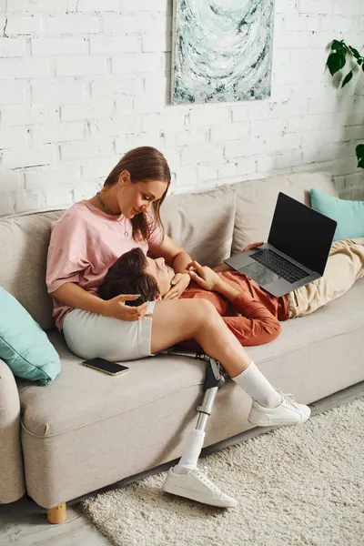 Mujer con la pierna protésica apoya la cabeza en novios regazo, él mira hacia arriba con cariño. - foto de stock