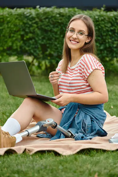 Uma jovem mulher com uma perna protética senta-se em um cobertor em um parque, usando um laptop enquanto sorri. — Fotografia de Stock