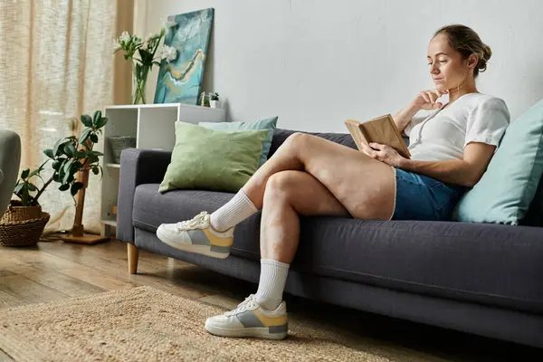 A woman with vitiligo relaxes on a couch, engrossed in her book, surrounded by cozy decor. — Stock Photo