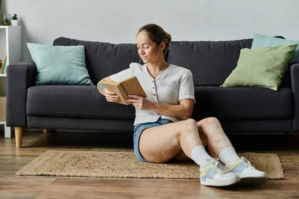 A young woman with vitiligo sits on the floor, absorbed in her book, surrounded by comfort. — Stock Photo