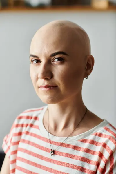 A young woman with alopecia confidently embraces her baldness in a cozy setting. — Stock Photo