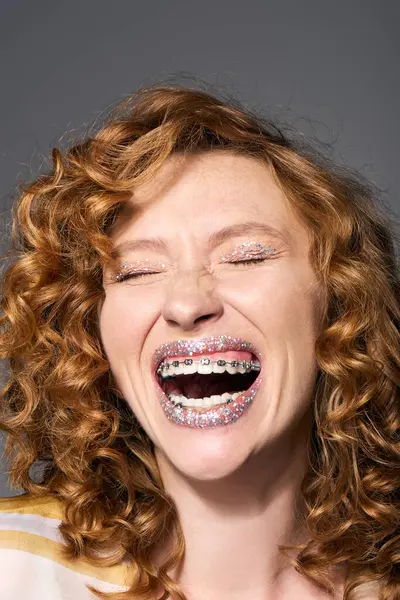 A young woman with curly hair joyfully posing cheerfully, showing off her braces and creativity. — Stock Photo