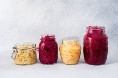 Mayalanmış lahana, havuçlu beyaz lahana ve tatlı biber, soğanlı kırmızı lahana, lahana turşusu.