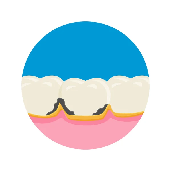 Стоматологічна Табличка Векторні Ілюстрації Символ Значка Зубного Болю — стоковий вектор