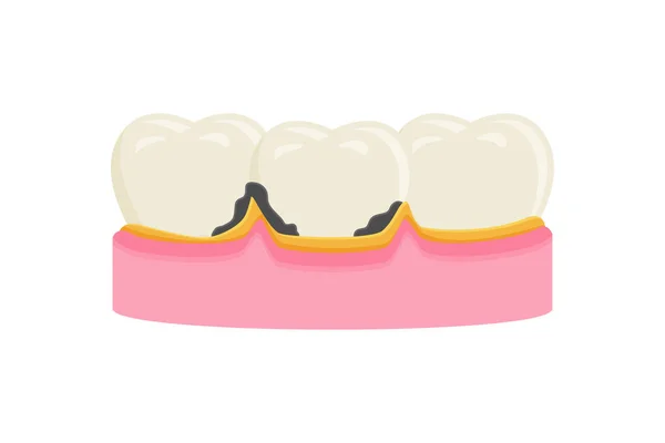 Illustration Vectorielle Plaque Dentaire Symbole Signe Icône Mal Dents — Image vectorielle
