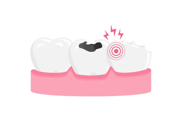 Çürük Diş Vektör Illüstrasyonu Diş Ağrısı Simgesi Simgesi — Stok Vektör