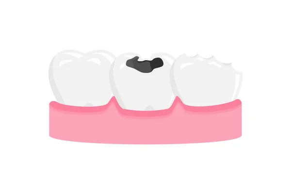 Illustration Vectorielle Dents Cavité Symbole Signe Icône Mal Dents — Image vectorielle