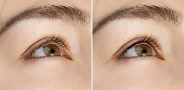 Closeup of female eye with comparison after professional permanent makeup treatment - lash line enhancement clipart