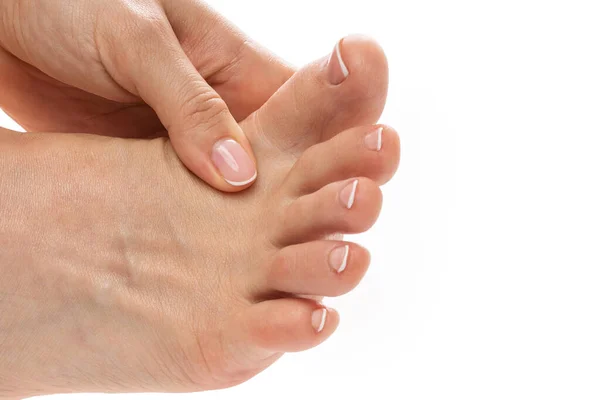 Detailní Záběr Ženských Nohou Svědivou Kůží Postiženou Plísňovou Infekcí — Stock fotografie