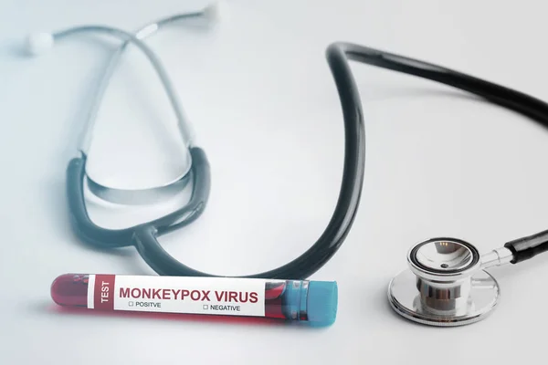 Vacutainer Com Monkeypox Amostra Sangue Para Testes Fundo Cinza — Fotografia de Stock