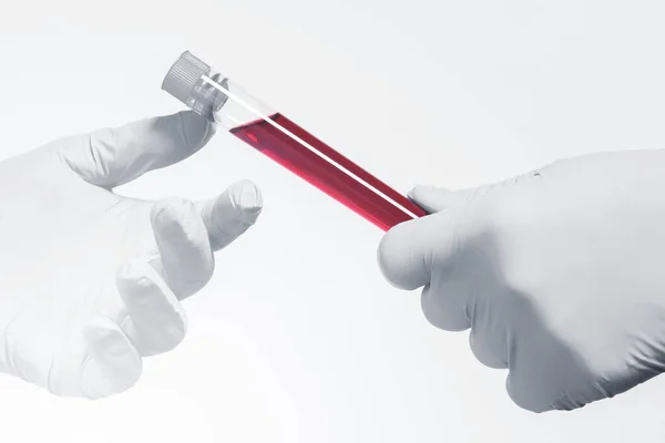 Stofzuiger Van Bloedmonster Wetenschapper Hand Dragen Latex Handschoenen Begrip Bloedonderzoek — Stockfoto