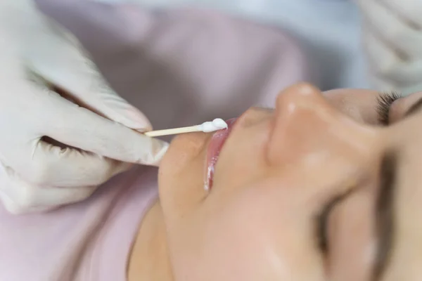 在口红手术前 专业的永久化妆师在病人的唇上涂上麻醉剂 — 图库照片