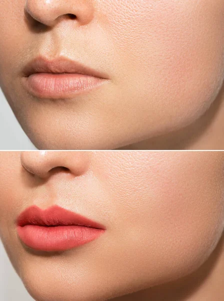Close Van Vrouwelijke Lippen Permanente Make Lip Blozen Procedure — Stockfoto