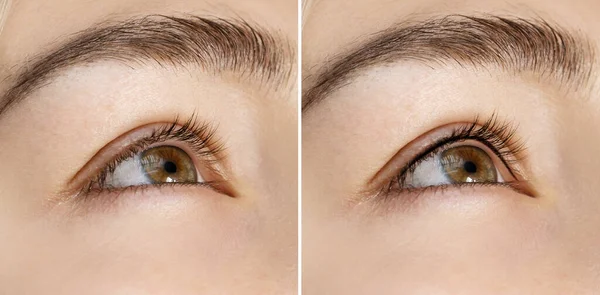 プロの永久的なメイク治療後の比較と女性の目の閉鎖 ラッシュラインの強化 — ストック写真