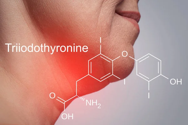 Weibliche Nacken Und Trijodothyronin Hormonformel Die Von Der Schilddrüse Produziert — Stockfoto