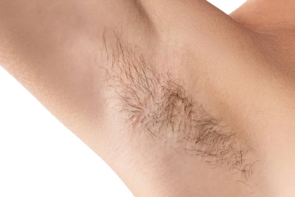 Closeup Hairy Female Armpit Concepts Health Hygiene — Stock Photo, Image