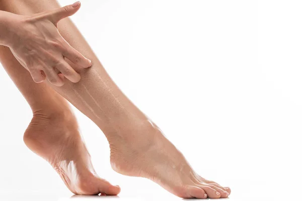 Κλείσιμο Των Θηλυκών Ποδιών Ξηρό Κνησμό Του Δέρματος Λευκό Φόντο — Φωτογραφία Αρχείου