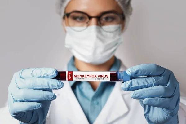 Nőstény Nővér Majomhimlő Vérmintáját Tartalmazó Vakcina Közelsége Vizsgálathoz — Stock Fotó