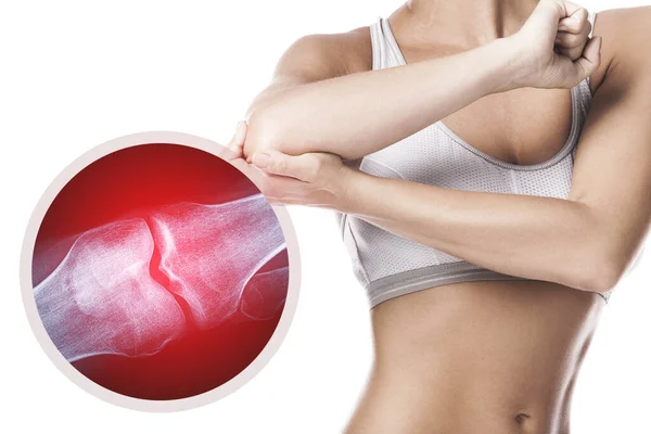 負傷した関節を持つ女性の肘とX線効果 — ストック写真