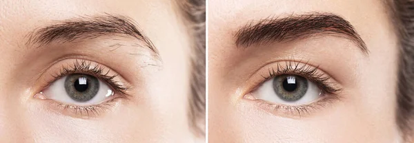 Comparison Female Brow Eyebrow Shape Correction Permanent Makeup — Stock Photo, Image