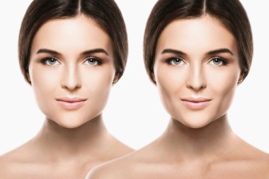 Female face comparison after successful buccal fat extraction plastic surgery clipart