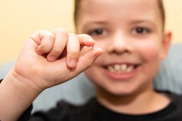 Uśmiechnięty Siedmiolatek Wyrwał Mleczny Ząb — Zdjęcie stockowe