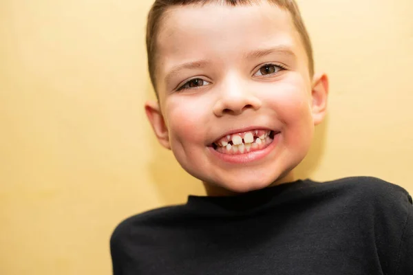 7歳の少年が乳の歯を２本失った — ストック写真