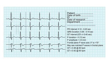 kardiyogram çizgileri, vektör çizimi