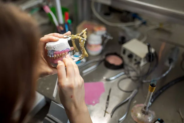 在瓦克斯铸成牙冠 牙医为病人做假牙 假牙的制备 图库图片