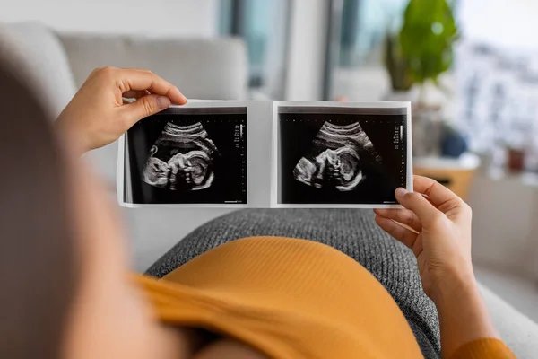 Zwangere Vrouw Kijkt Naar Eerste Echografie Foto Van Haar Baby — Stockfoto
