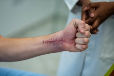 Hasta hala hastanedeyken, ameliyattan sonra adamın kolunda yaralar var. Ameliyattan sonra bileğinde dikişler olan bir yara..