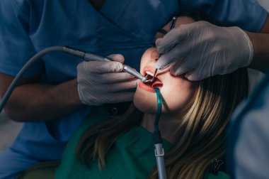 Genç beyaz kadın dişçi muayenehanesinde dişlerini kontrol ettiriyor. Diş sandalyesindeki hasta dişlerini tamir ediyor. Sağlıklı gülümseme kavramı. Hasta ağzı ışıkla aydınlatılıyor.