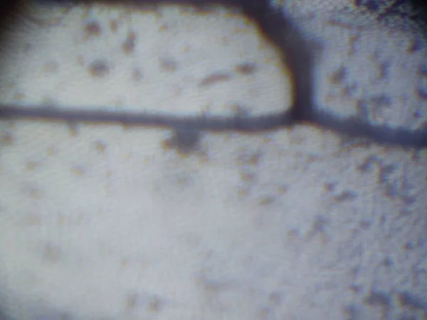 Μικροσκοπική Φωτογραφία Του Ιστού Του Εντόμου — Φωτογραφία Αρχείου