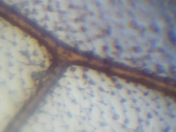 Микроскопическая Фотография Ткани Насекомого — стоковое фото