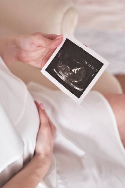 Ultrasound scan of pregnancy. Expecting a baby. Pregnancy and parenthood.