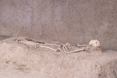 Ameliyat müdahalesiyle antik insan iskeleti arkeolojik kazılarda ortaya çıkarıldı.