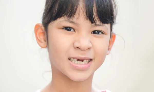 Dentes Leite Perdidos Dente Leite Perdido Rosto Sorriso Uma Criança — Fotografia de Stock