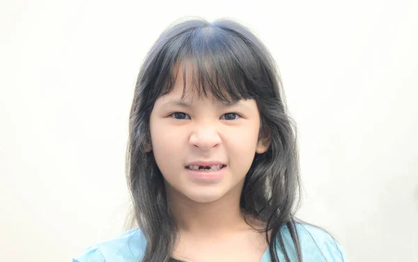 Втрачені Молочні Зуби Втрачений Дитячий Зуб Посмішка Обличчя Дитини Дитячі — стокове фото