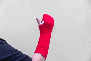 broken arm bone in cast (Red)
