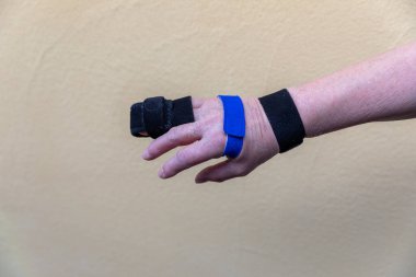 two sided finger splint with two hook and loop straps on a broken finger