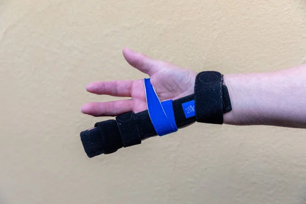 two sided finger splint with two hook and loop straps on a broken finger