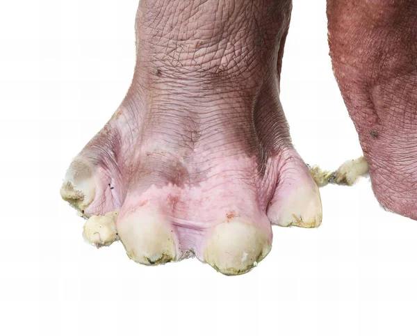 Eine Nahaufnahme Der Füße Einer Person Mit Weißem Hintergrund Eine — Stockfoto