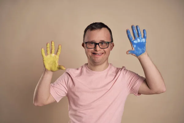 Hombre Con Síndrome Con Las Manos Pintadas Colorido —  Fotos de Stock