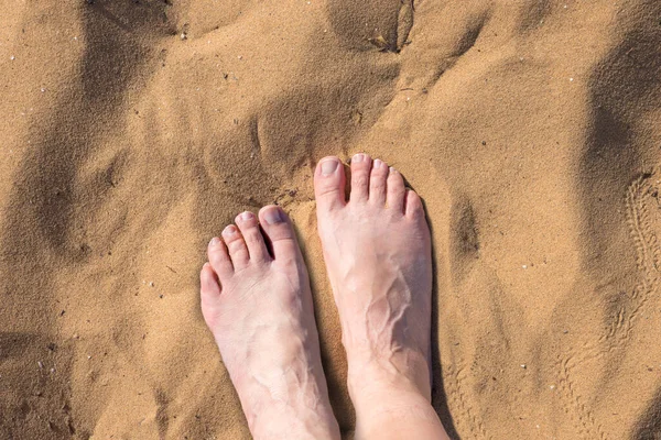 Feet Elderly Woman Standing Hot Sand — Stock Photo, Image