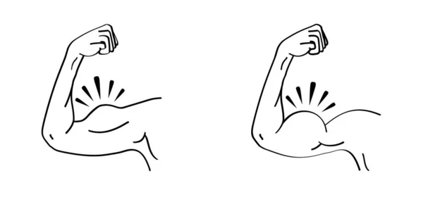 Biceps Desenhos Animados Símbolo Cotovelo Humano Desenho Contorno Vetorial Avc —  Vetores de Stock