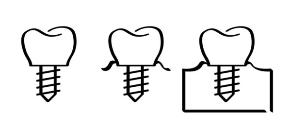 Implante Dental Médicamente Preciso Puente Dental Dibujos Animados Sanos Diente — Vector de stock