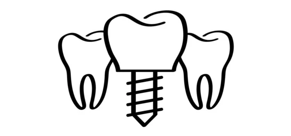 歯科インプラント 医療的に正確または歯科ブリッジ 漫画の健康 歯茎と歯 モル線のパターン 歯をネジで描く 歯や歯に損傷を与えます 外科用顎 医療用ネジ — ストックベクタ