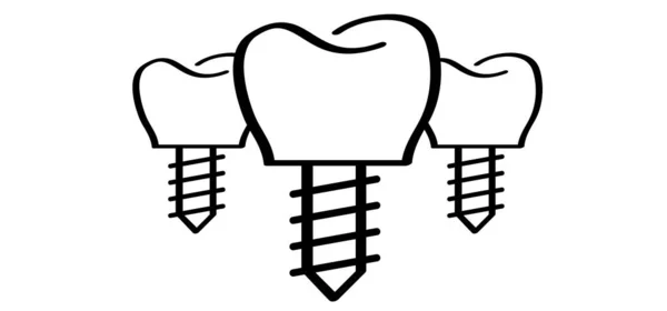 Implants Dentaires Pont Médicalement Précis Dentaire Dessin Animé Sain Dent — Image vectorielle